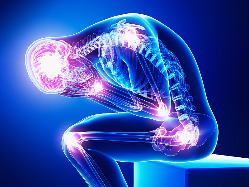  What the Newest Study Says About Cannabis and Chronic Pain