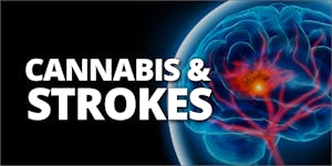 Studies Show Surprising Link Between Cannabis And Strokes