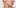 Skin Deep 4 5 Skin Deep #4: Does Cannabis Solve Acne Problems?