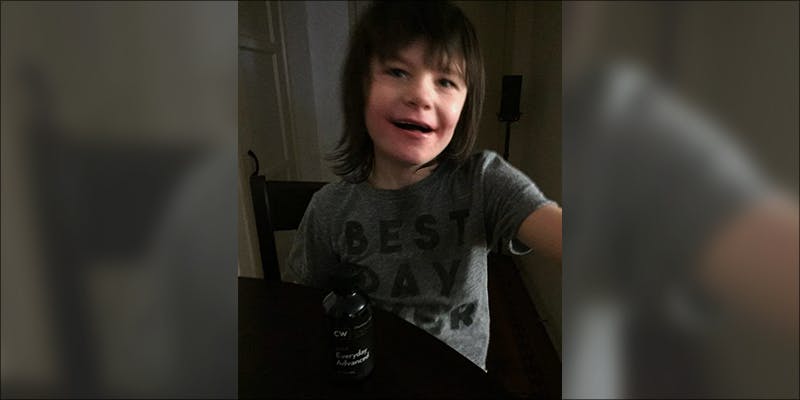 Boys Epileptic Fits 1 Medical Cannabis Has Stopped the Epileptic Seizures in This Young Boy