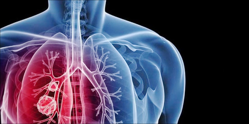 Donate Lungs 4 New Study Confirms Cannabis Consumers Can Donate Lungs