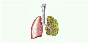 New Study Confirms Cannabis Consumers Can Donate Lungs