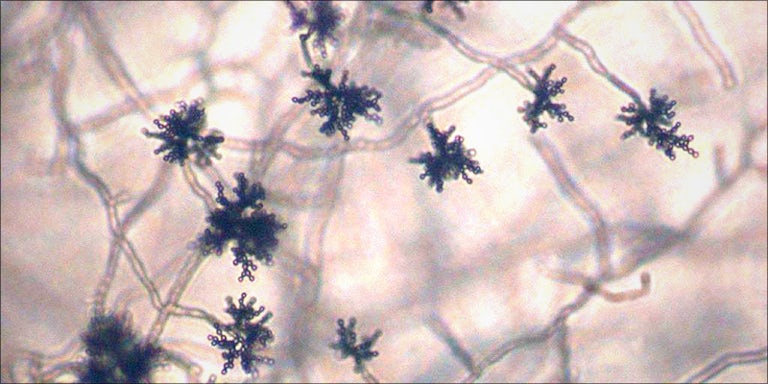 This Is Why Smoking Moldy Weed Can Make You Sick Herb Why Smoking Moldy 4 Nypd Officers Destroyed On Twitter After Bragging About Tiny Weed Bust