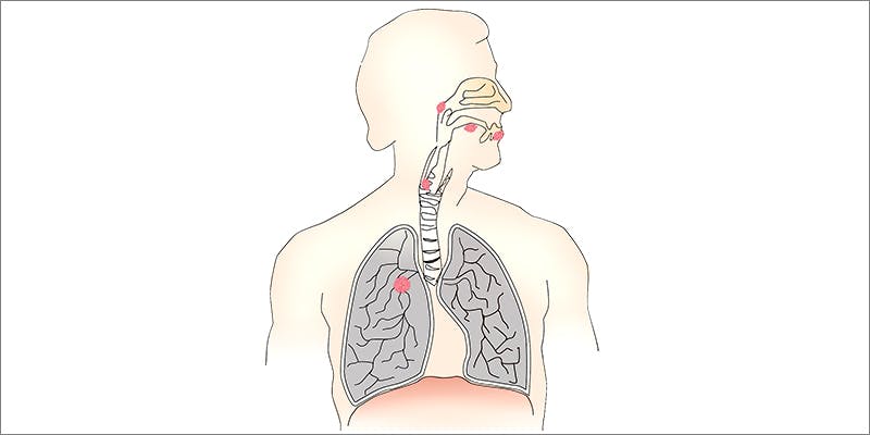 Reasons To Love 5 5 Reasons To Love Cannabis Roots And How To Effectively Use Them