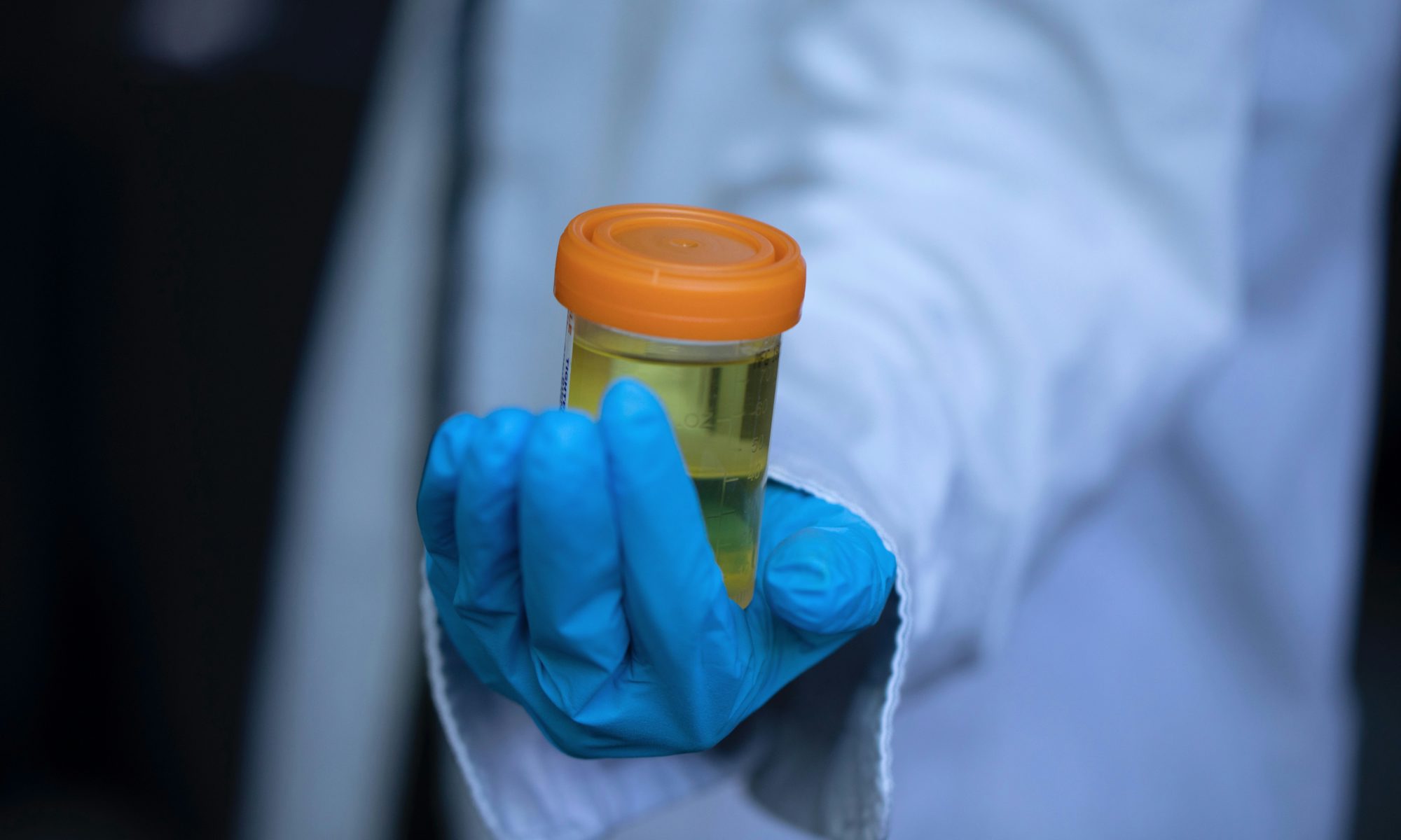 How Long Does Weed Stay in Your System 01 e1537198910795 How Long Does Weed Stay In Your Urine?