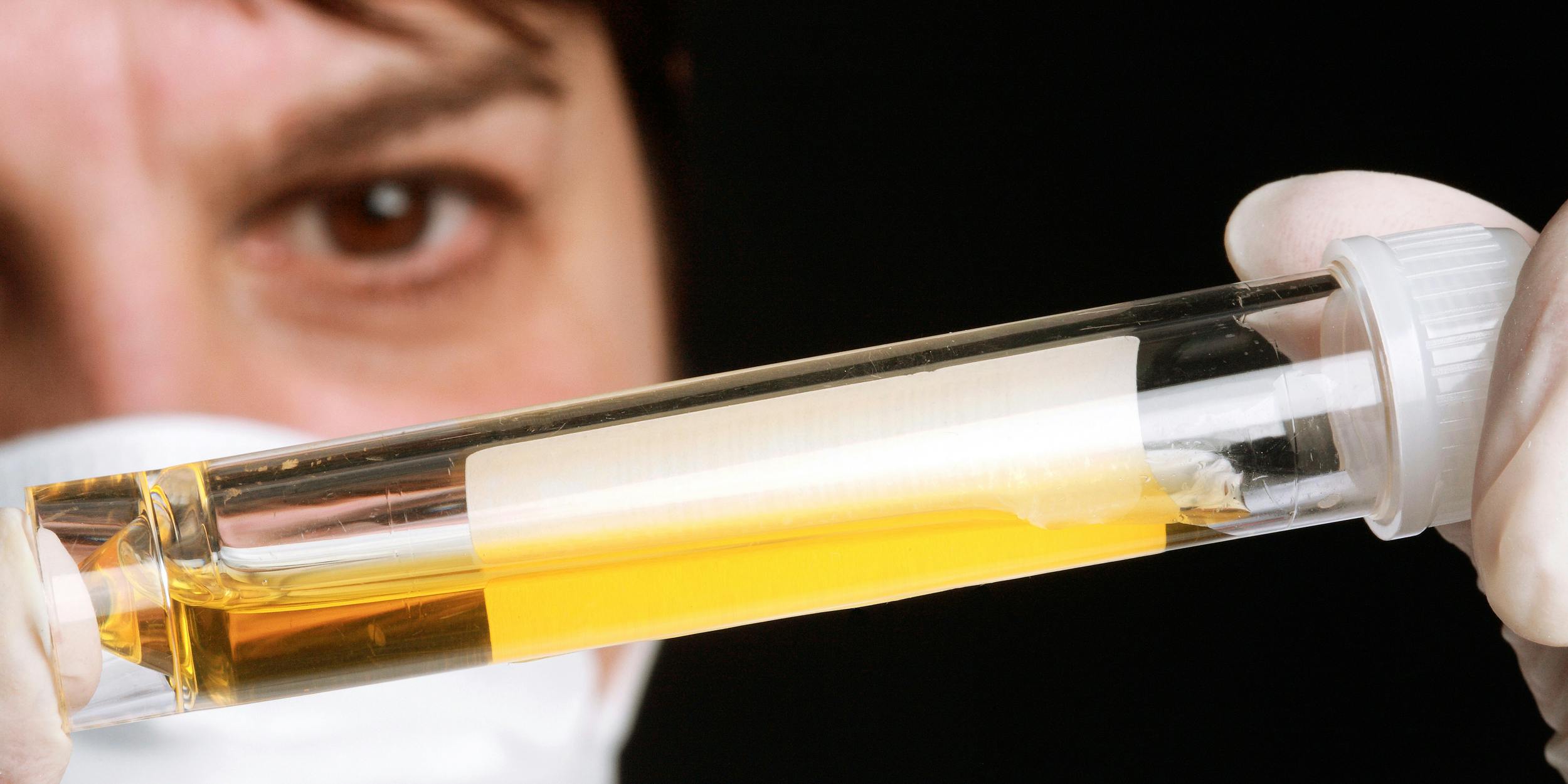 Pass Your Drug Test and Get Healthy at the Same Time With This THC Detox Kit