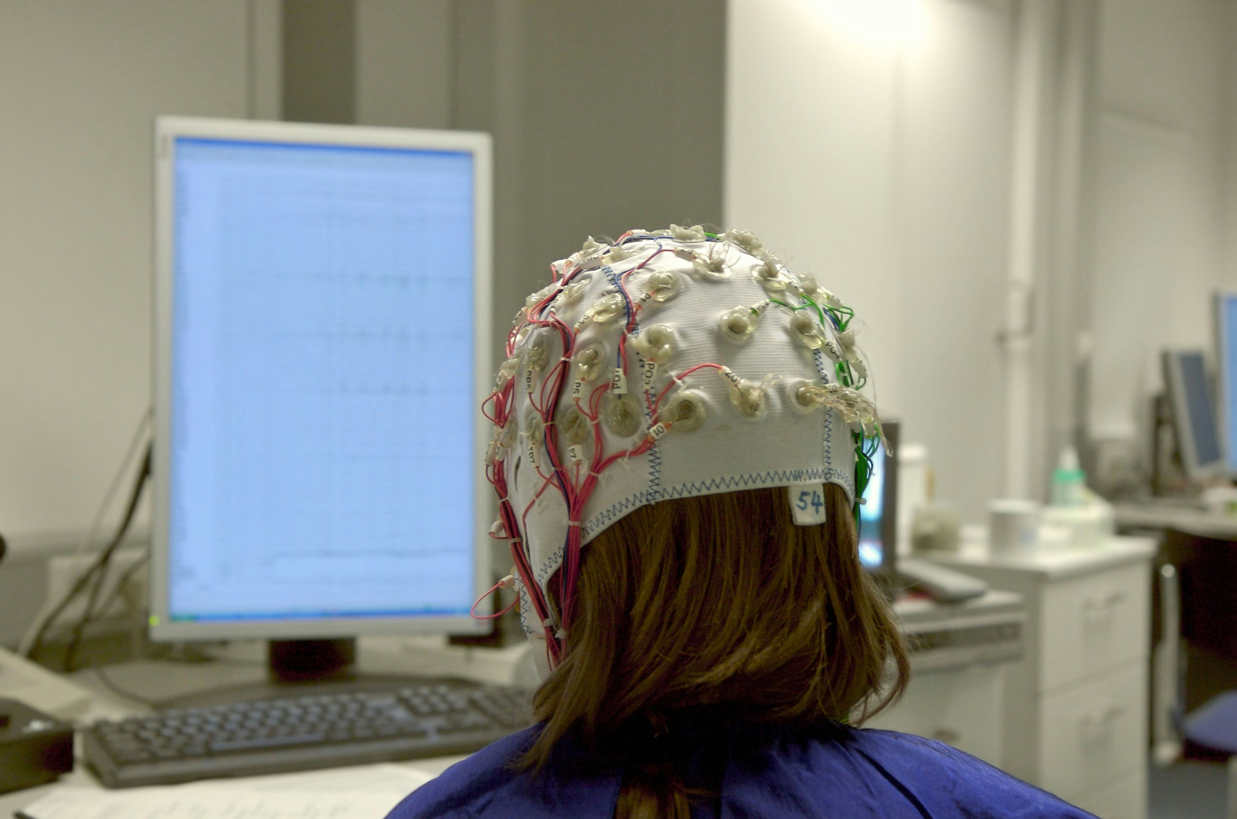 1 Cannabis Users Get %E2%80%98Noisy Brain%E2%80%99 Research Suggests These Are The Best Cannabis Strains for ADHD/ ADD