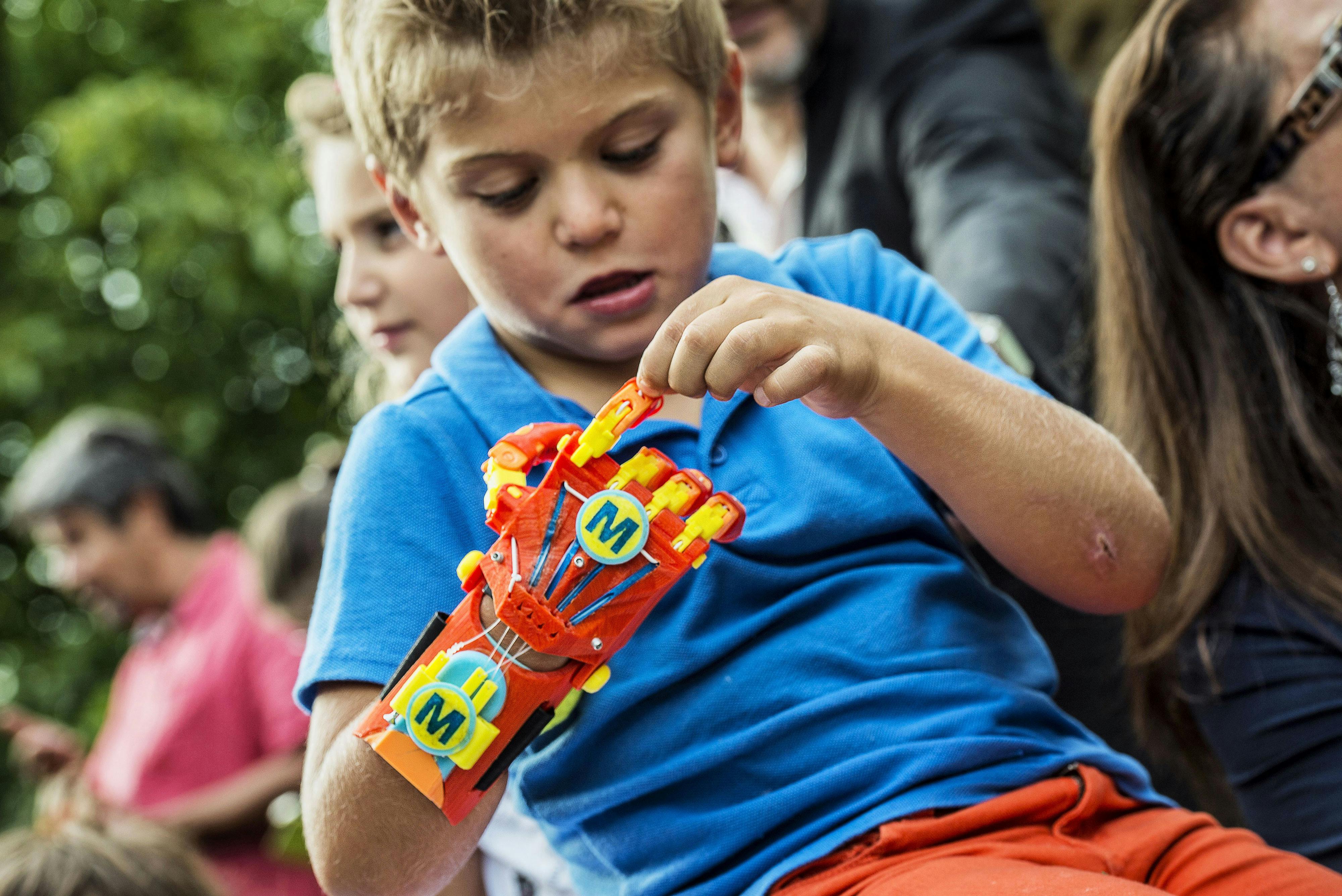 Kindness 3d is turning cannabis waste into prosthetic limbs. Here, a kid is shown examining his new 3d printed hand