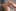 CBD for Psoriasis3 CBD for Psoriasis: Can Cannabidiol Help Itching, Irritated Skin?